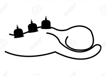 HIJAAMALLA (KUPPAUKSELLA) HOITAMINEN